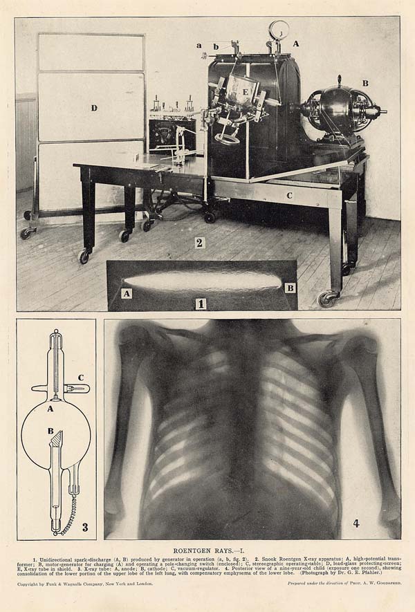 print Röntgen Rays I by Funk&Wagnalls Company