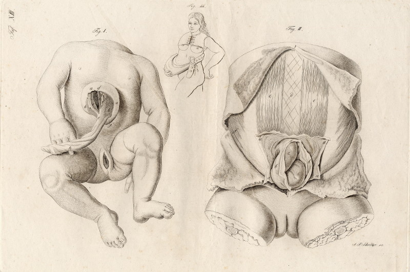 Anatomische prent van een kind by Johann Friedrich Schröter