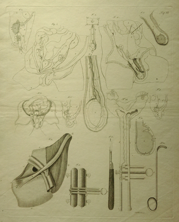 print Anatomische prent van mannelijk geslachtsorgaan by Johann Friedrich Schröter