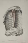 small image of the print Tab. XIX Friedrich Tiedemann Tabulae arteriarum thmbnail of Tab. XIX Friedrich Tiedemann Tabulae arteriarum