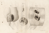 small image of the print Anatomische prent thmbnail of Anatomische prent