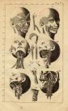small image of the print Anatomische prent van spieren op het hoofd thmbnail of Anatomische prent van spieren op het hoofd